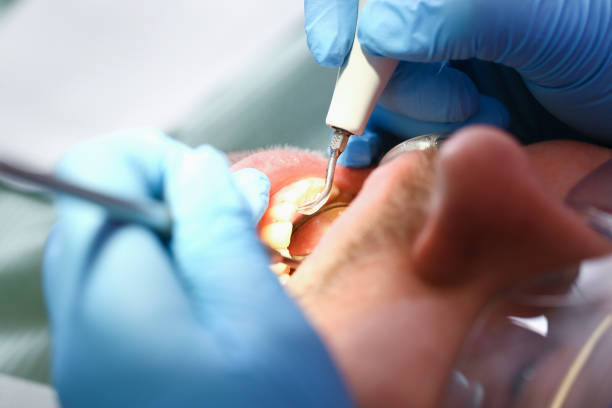 Best Emergency Dental Care for Trauma or Injury in Wyong, MI
