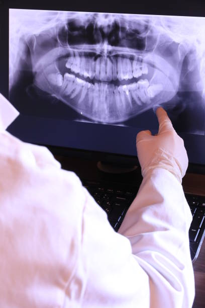 Best Emergency Tooth Extraction in Wyong, MI
