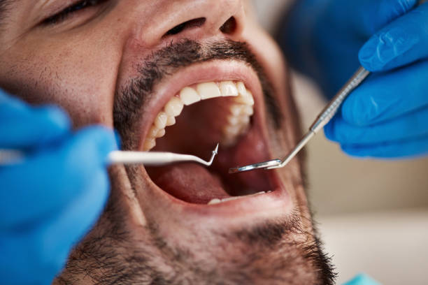 Best Walk-In Emergency Dentist in Wyong, MI